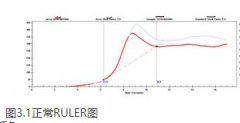 润滑油检测中抗氧化剂含量(RULER)是什么？